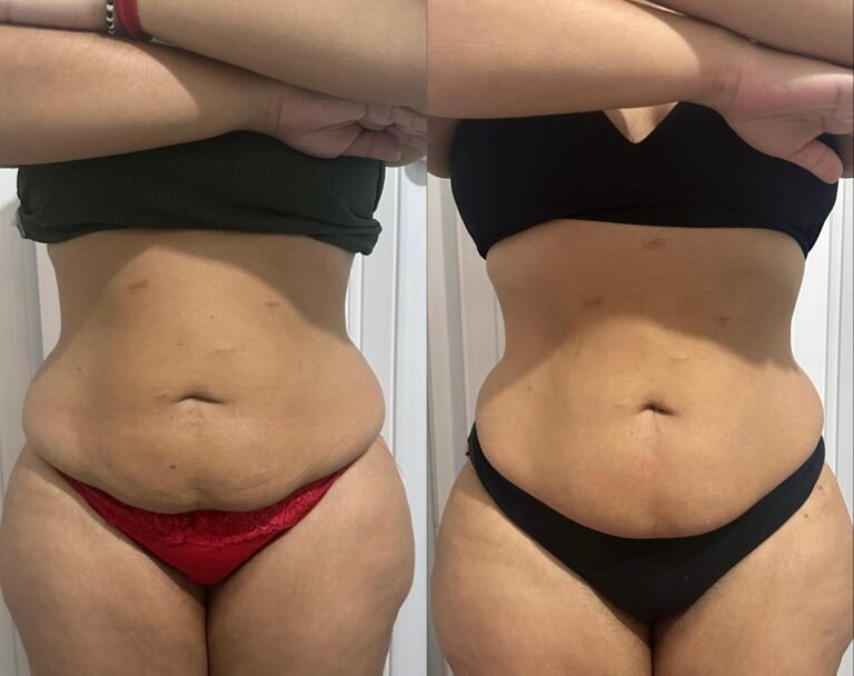 PACOTE MENSAL DE GORDURA ZERO